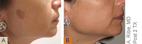 Slider image (9) Victor Regenerative Medicine Centers